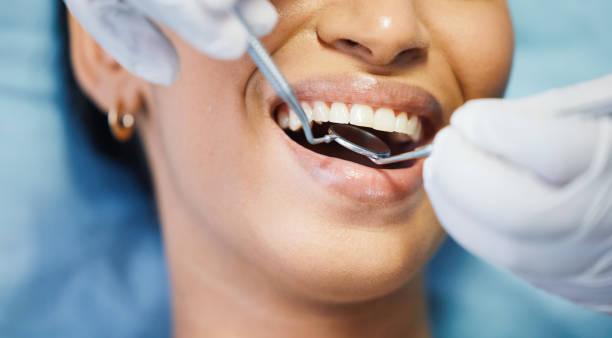 Best Emergency Dentist for Lost Fillings or Crowns in Howland Center, OH